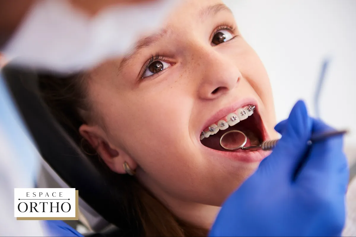 Comment l'Orthodontie Peut Améliorer l'Alignement de Vos Dents