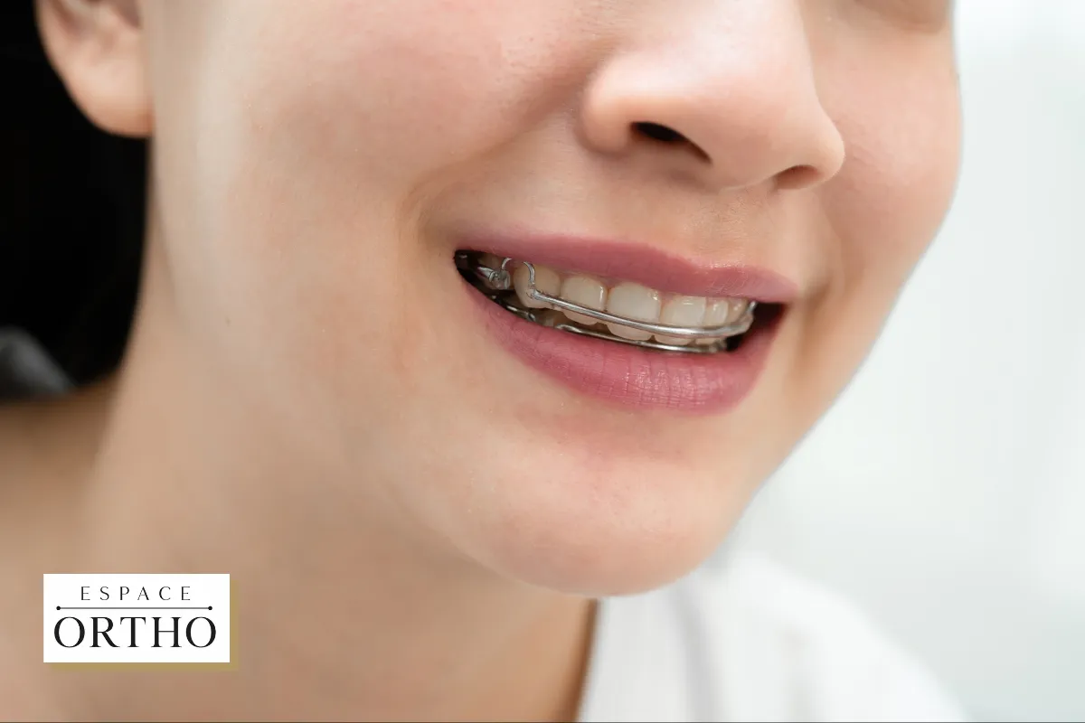 Les Avantages des Traitements Orthodontiques pour Votre Santé Dentaire