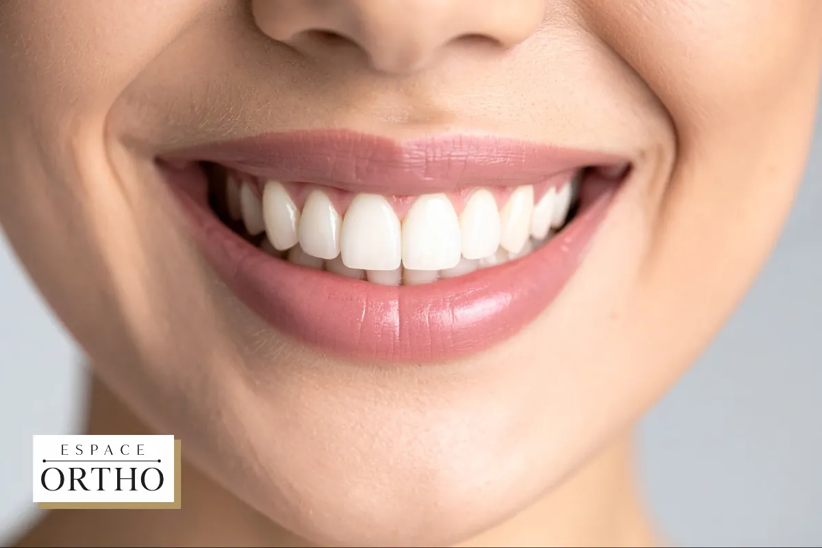Les Bienfaits de l_Orthodontie pour Votre Sourire