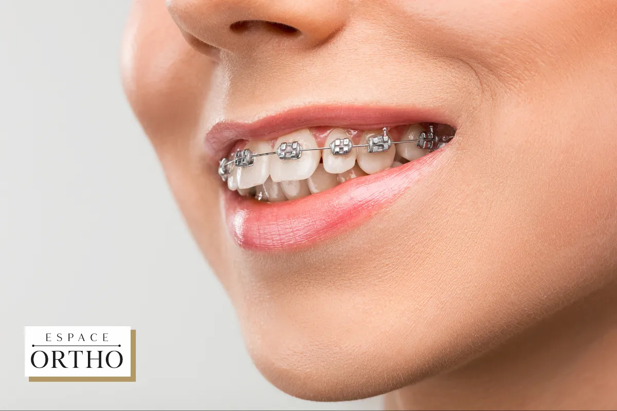 Orthodontie à Bois-des-Filion, Laval, Québec dans un Cadre Dentaire Familial