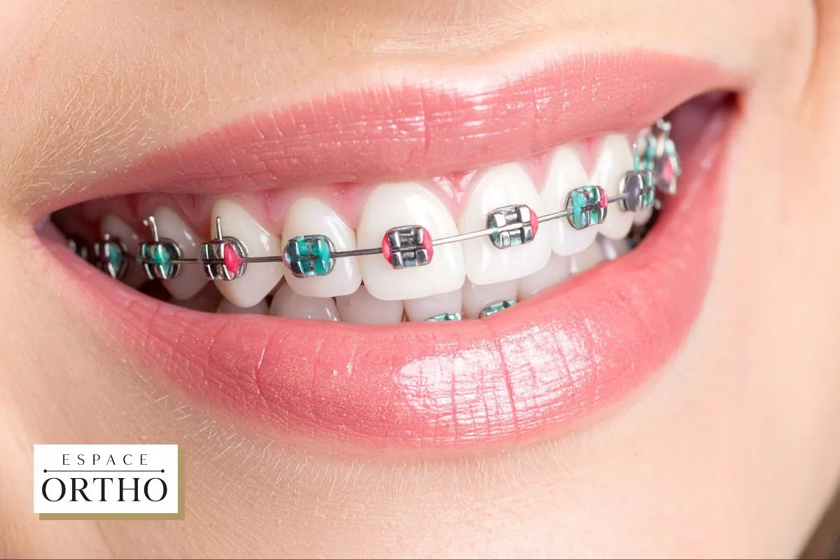 Orthodontie à Chomedey, Laval, Québec avec Évaluation Complète