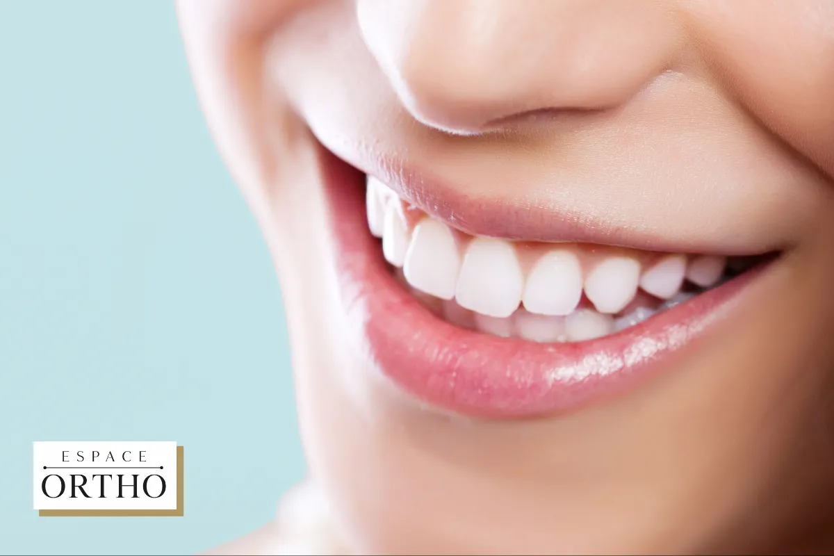 Orthodontie à Duvernay, Laval, Québec avec une Approche Personnalisée