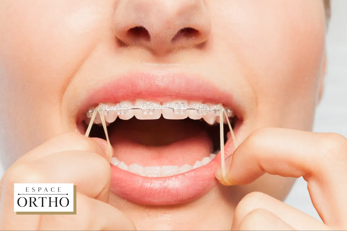 Pourquoi l_Orthodontie Adulte est Bénéfique