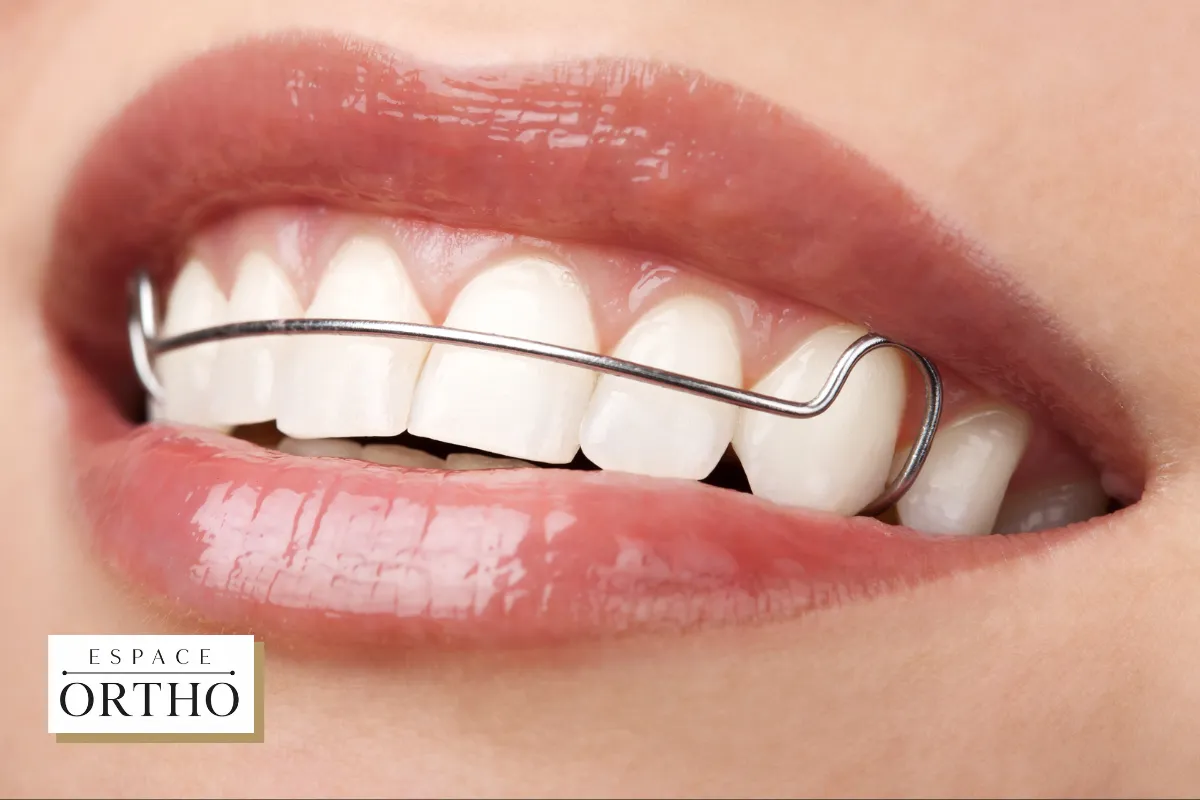 Solutions Orthodontiques Modernes à Champfleury, Laval