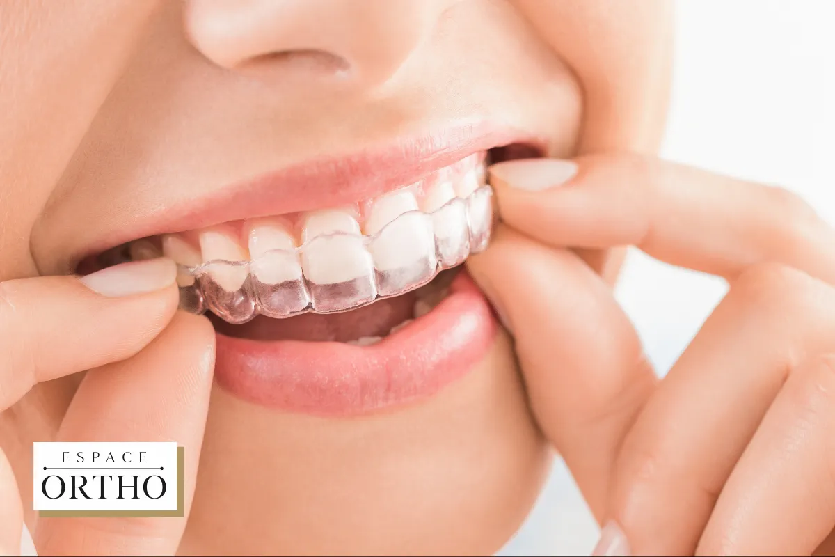 Traitement Invisalign à Laval, Québec